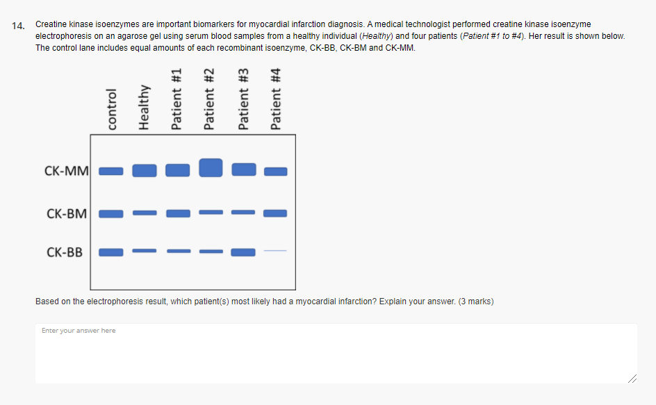 creatine kinase in myocardial infarction