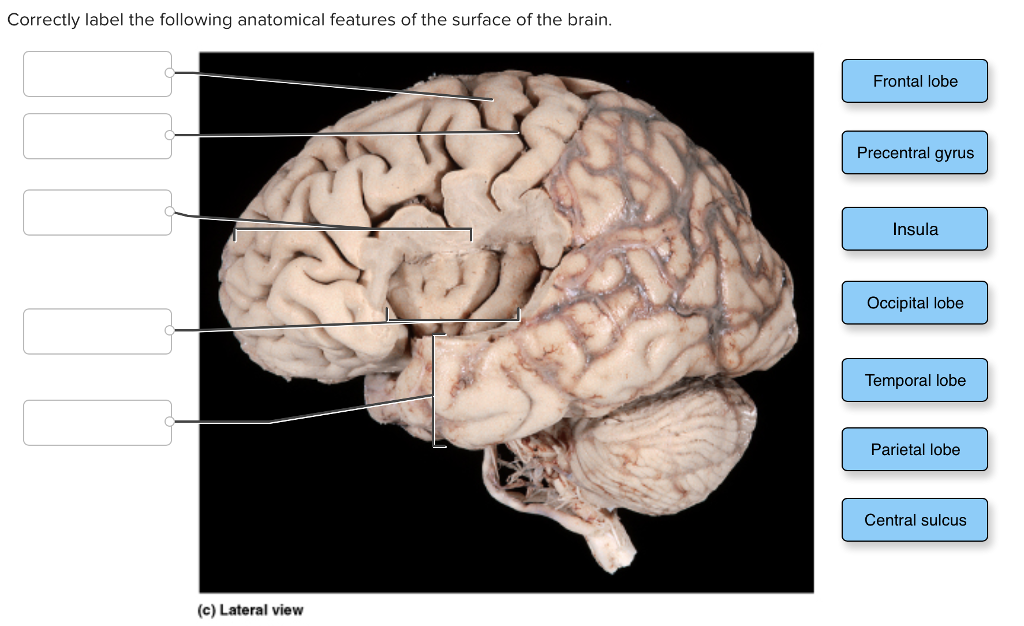 Solved Correctly label the following anatomical features of | Chegg.com