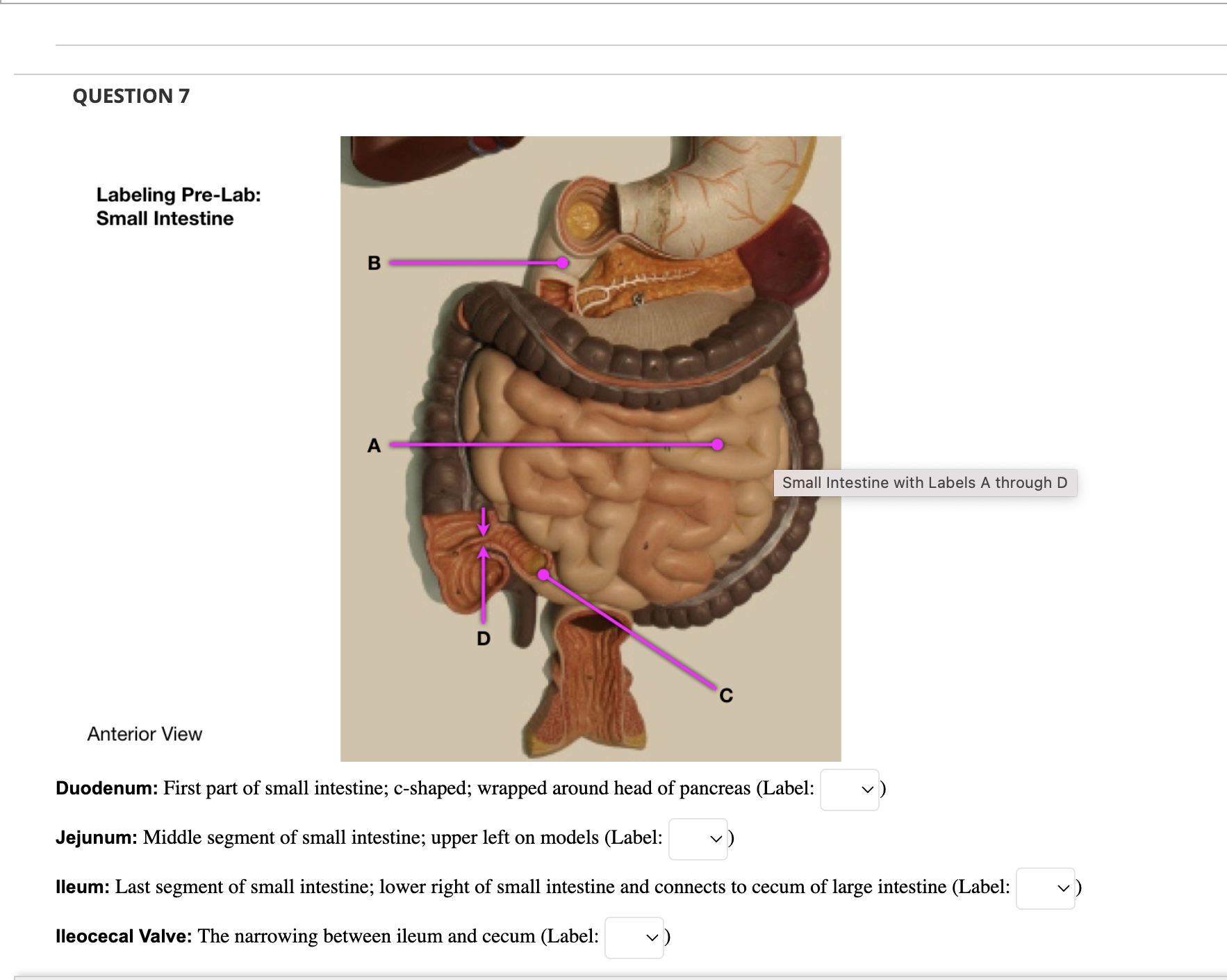 Solved QUESTION 1 Trachea: Airway; anterior to the esophagus | Chegg.com