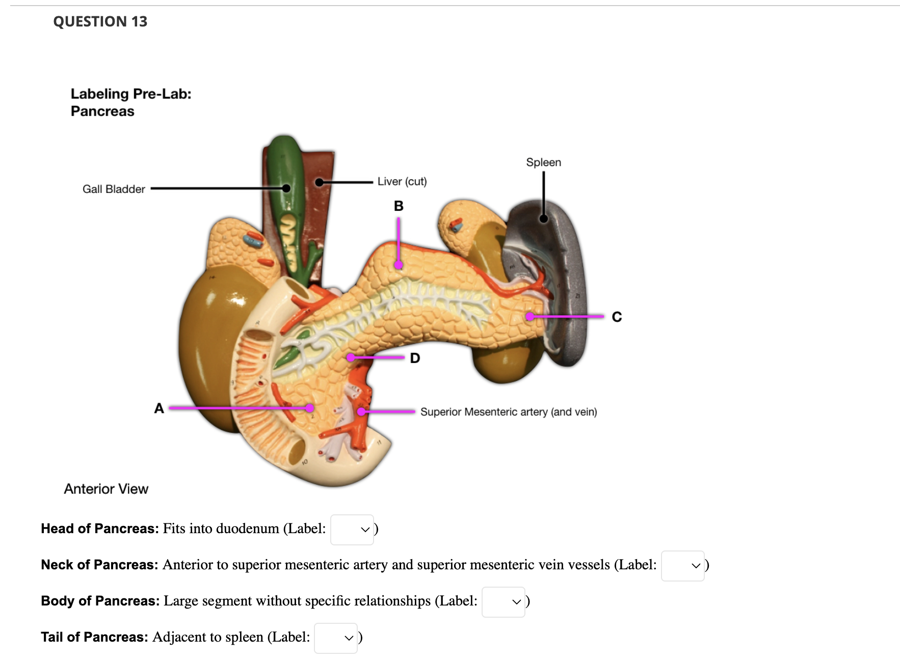 Solved Labeling Pre-Lab: Large Intestine J Anterior View | Chegg.com