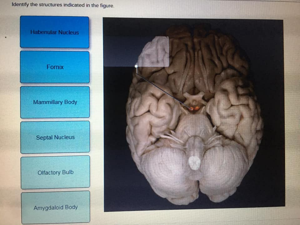 solved-which-structure-is-highlighted-thalamus-medulla-chegg