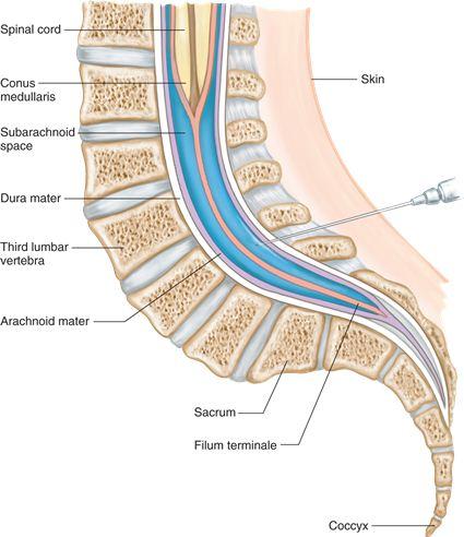 lumbar puncture layers