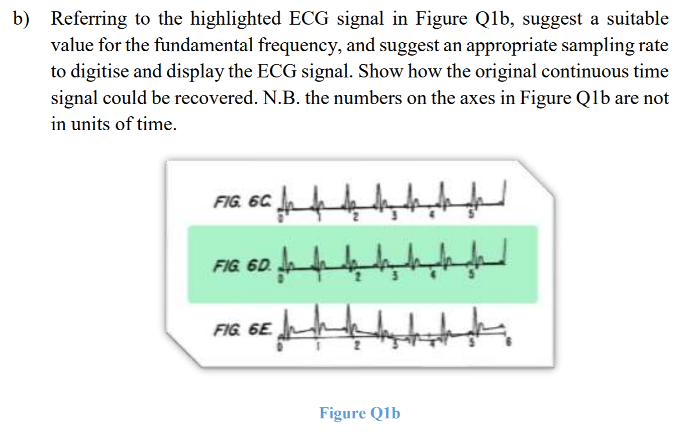 B) Referring To The Highlighted ECG Signal In Figure | Chegg.com