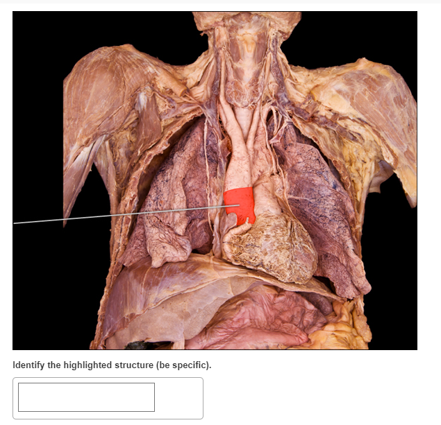 Identify the highlighted structure (be specific).
