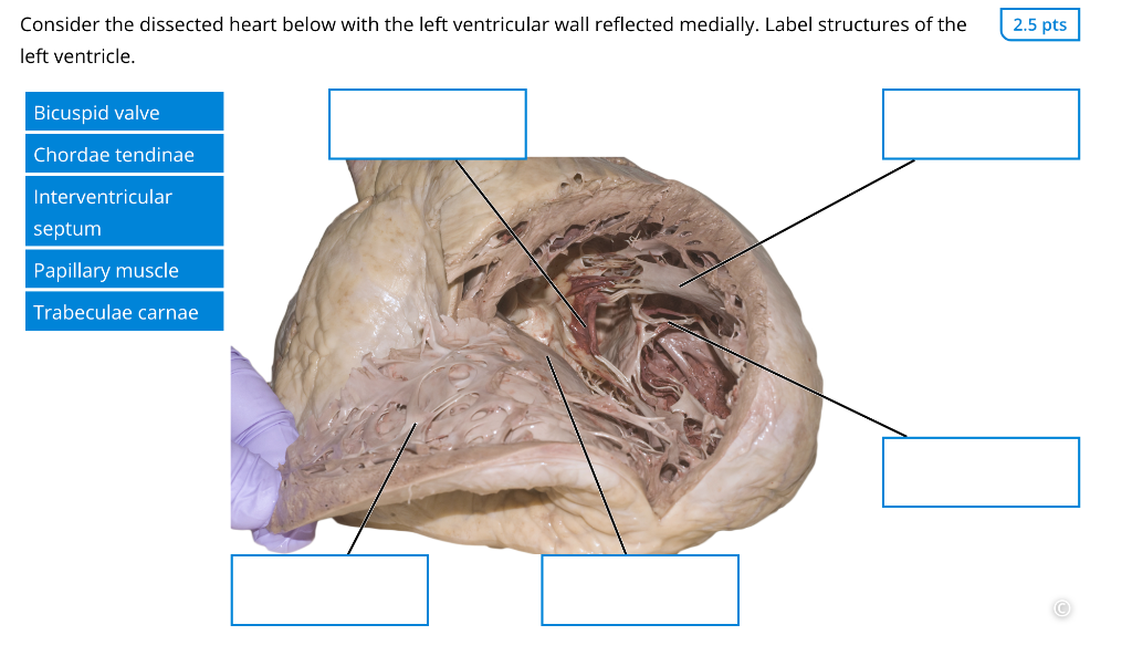 Consider the dissected heart below with the left ventricular wall reflected medially. Label structures of the left ventricle.