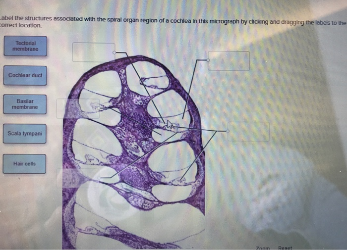 Solved abel the structures assoclated with the spiral organ | Chegg.com