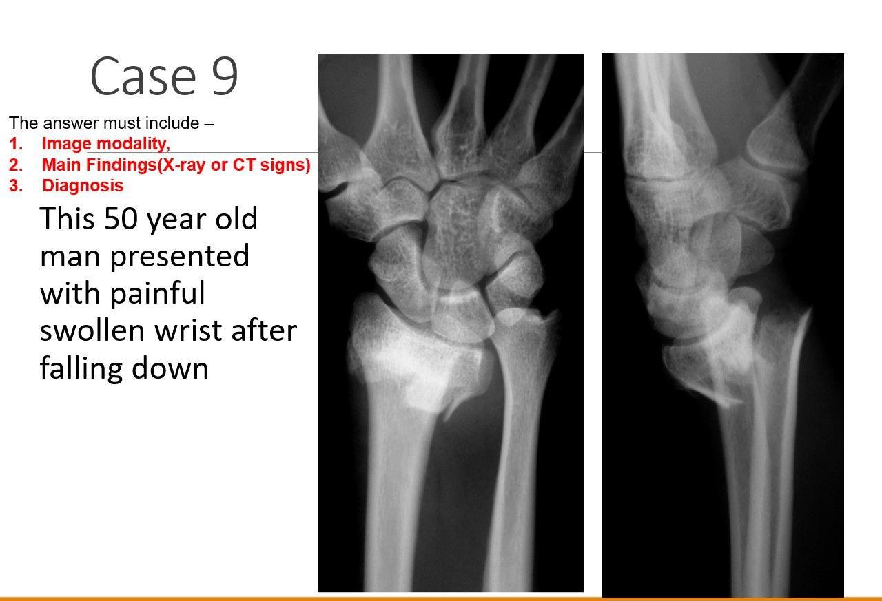 Solved 1. Image modality, 2. Main Findings(X-ray or CT | Chegg.com