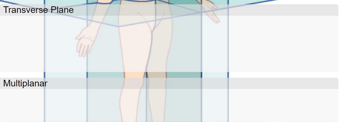 Solved Joint Rotations planar qualification given the | Chegg.com