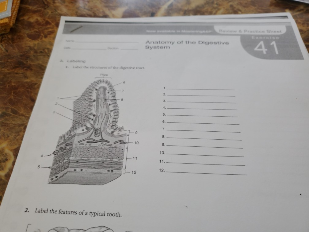 Solved FI ,"w & Practico Shoot Anatomy of the Digestive | Chegg.com