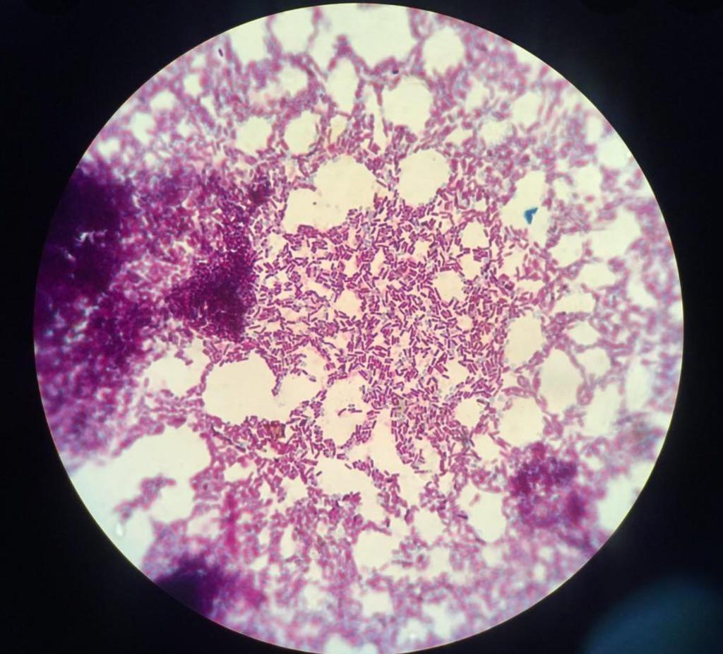 Solved What is the name of bacteria for each gram staining | Chegg.com