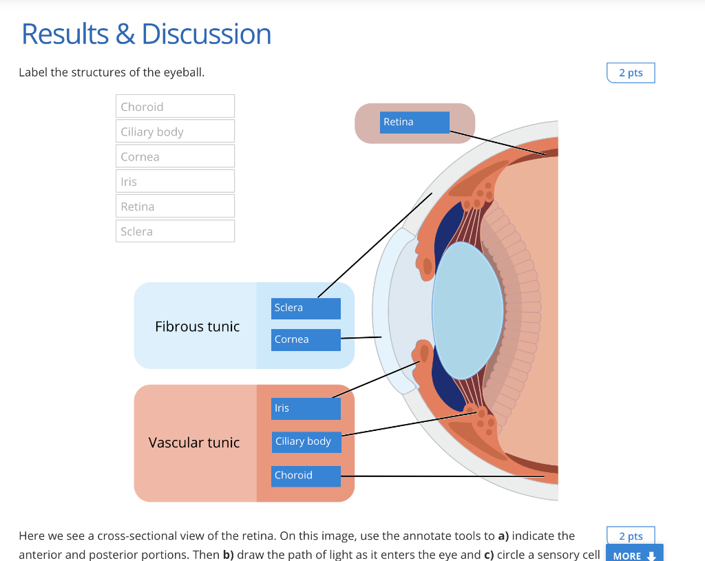 Solved Results & Discussion Label the structures of the | Chegg.com