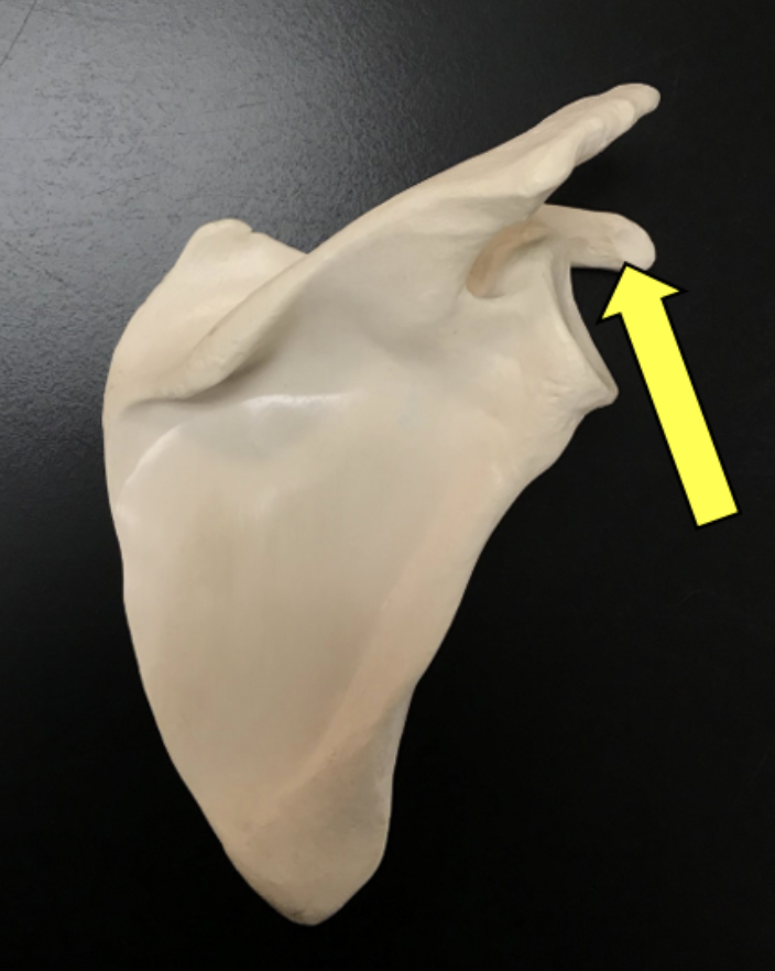 Solved I Identify the bone. Identify the bone marking | Chegg.com