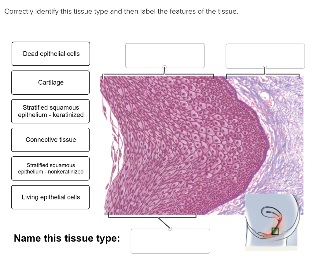 30 Correctly Identify This Tissue Type And Then Label The Features Of
