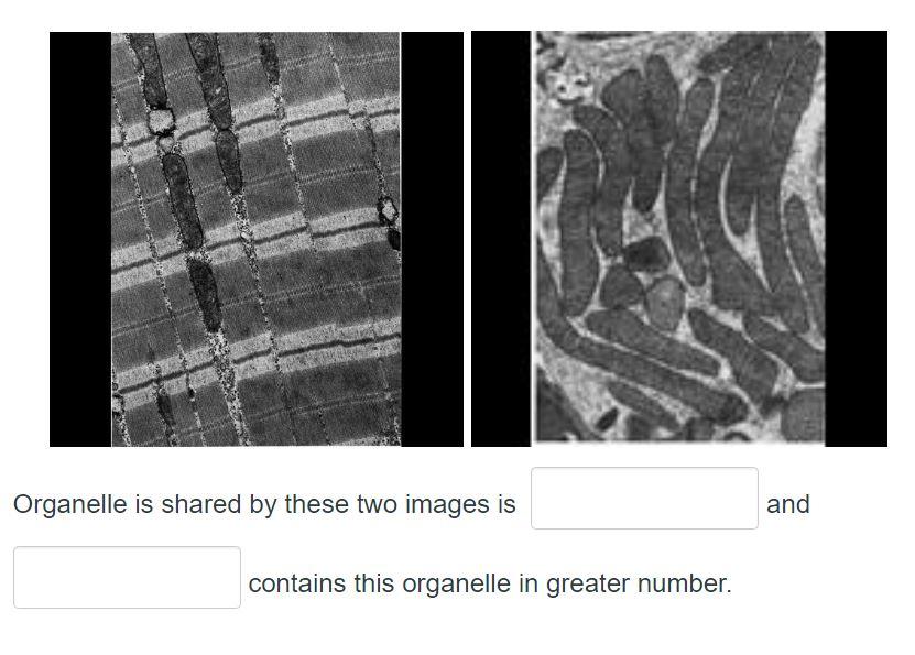 Solved NEWS Organelle is shared by these two images is and | Chegg.com