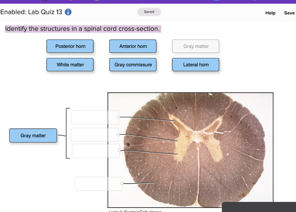 Identify the structures in a spinal cord cross-section.