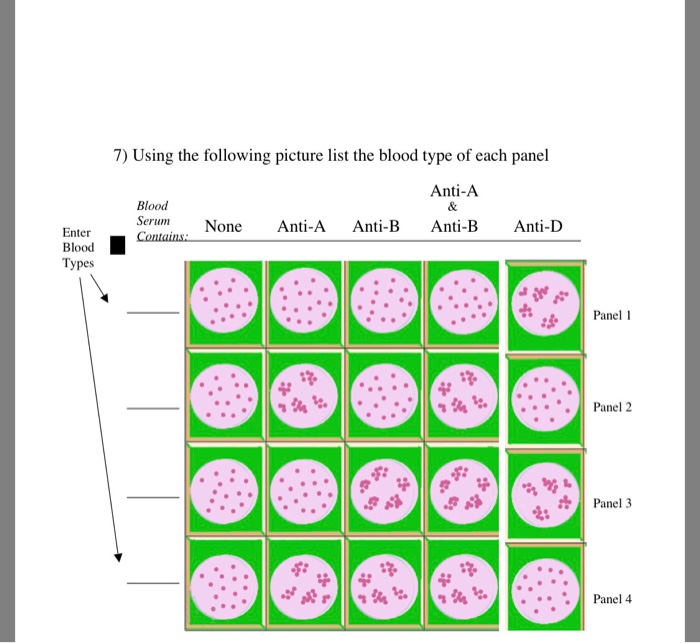 solved-7-using-the-following-picture-list-the-blood-type-of-chegg