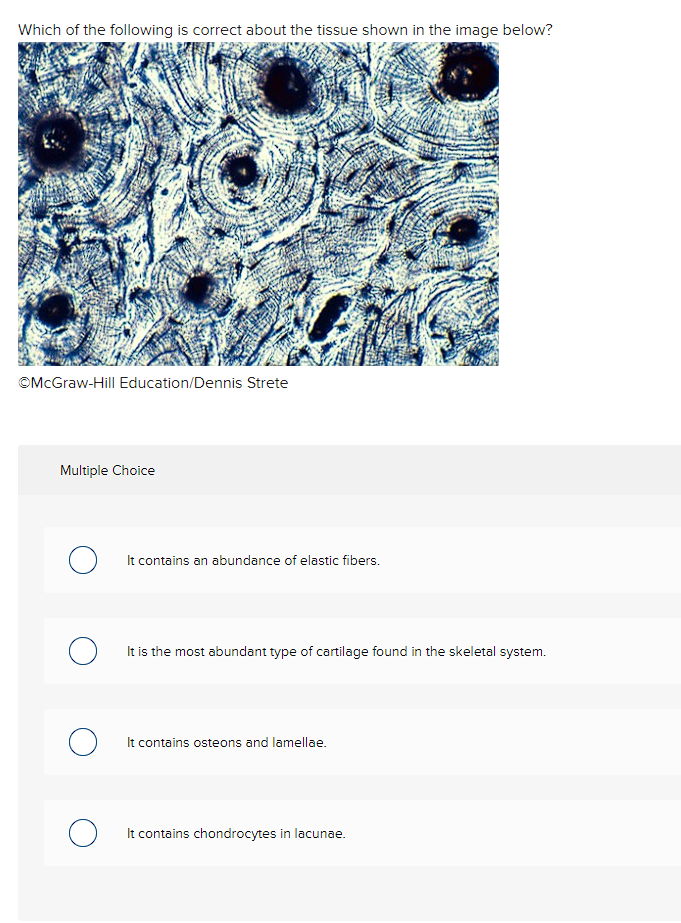 Solved Which of the following is correct about the tissue | Chegg.com