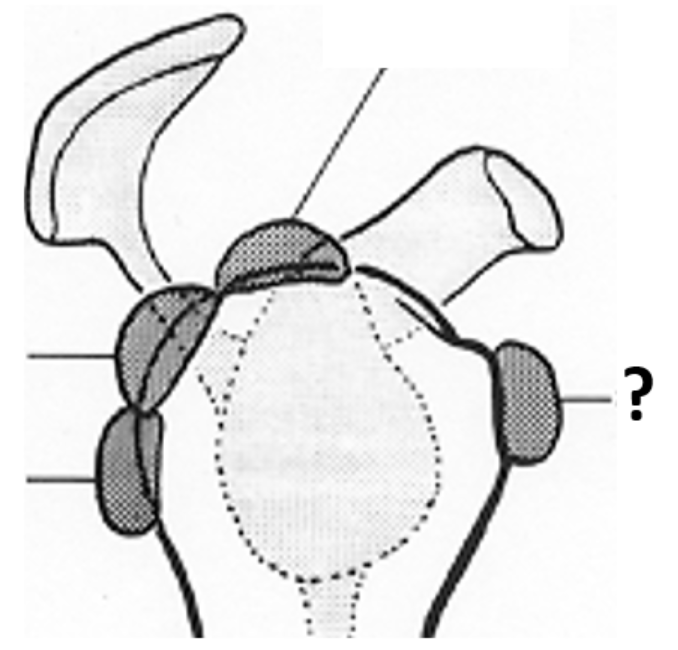 ¿