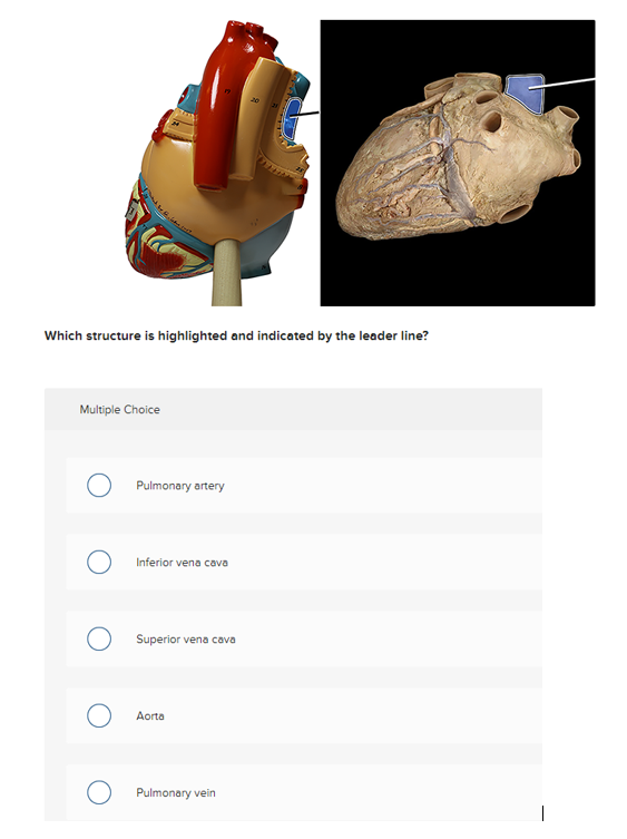 anterior-cardiac-vein