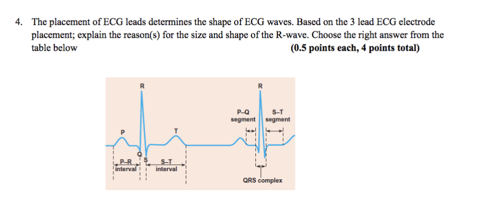 Solved 4. The placement of ECG leads determines the shape of | Chegg.com