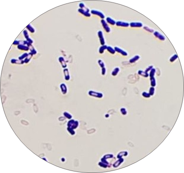 Solved 1. To identify the bacteria cultured from the | Chegg.com