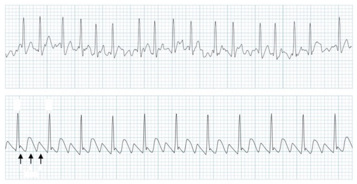 Solved Q1. The two graphs show two abnormal parts of an | Chegg.com