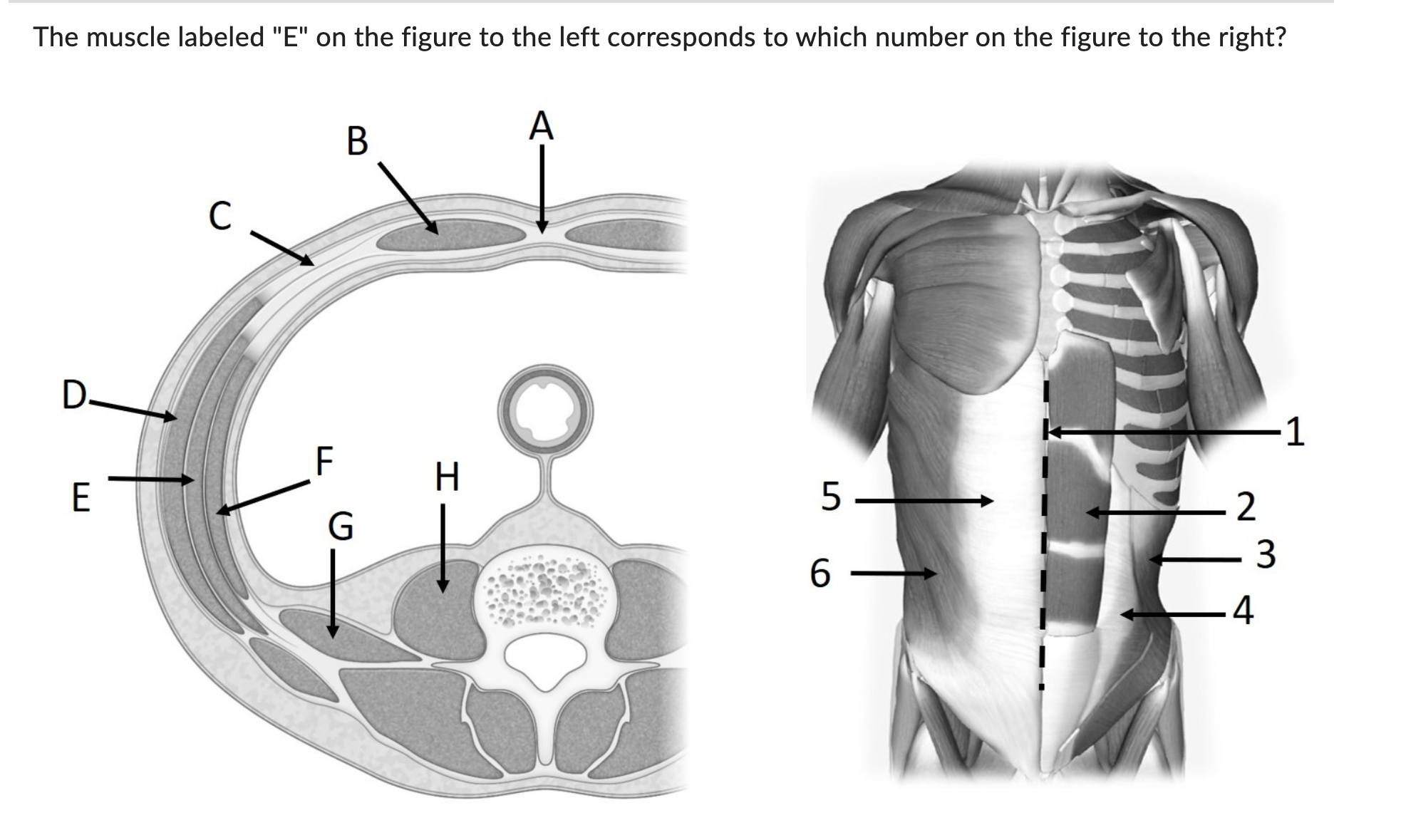 Solved The muscle labeled "E" ﻿on the figure to the left | Chegg.com