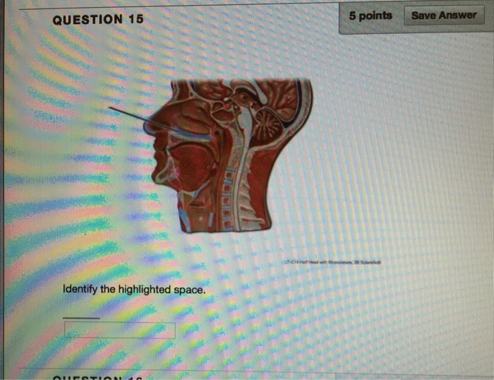 Solved QUESTION 17 5 points Save A Identify the highlighted | Chegg.com