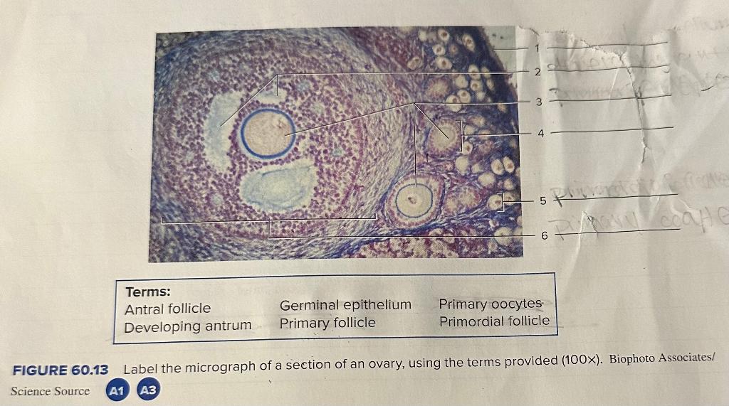 FIGURE 60.13 Label the micrograph of a section of an ovary, using the terms provided (100x). Biophoto Associates/
Science Sou