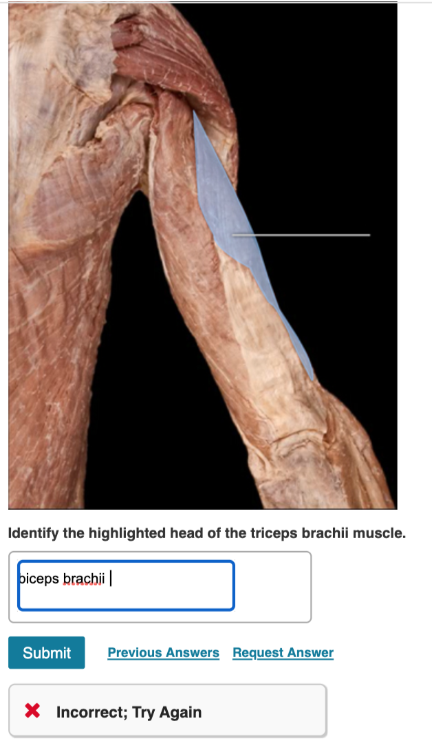 Solved Identify the highlighted head of the triceps brachii
