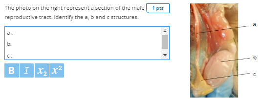 The photo on the right represent a section of the male reproductive tract. Identify the \( a, b \) and \( c \) structures.