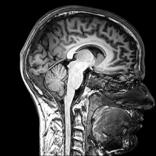 Solved 1. What type of section is demonstrated by this MRI | Chegg.com