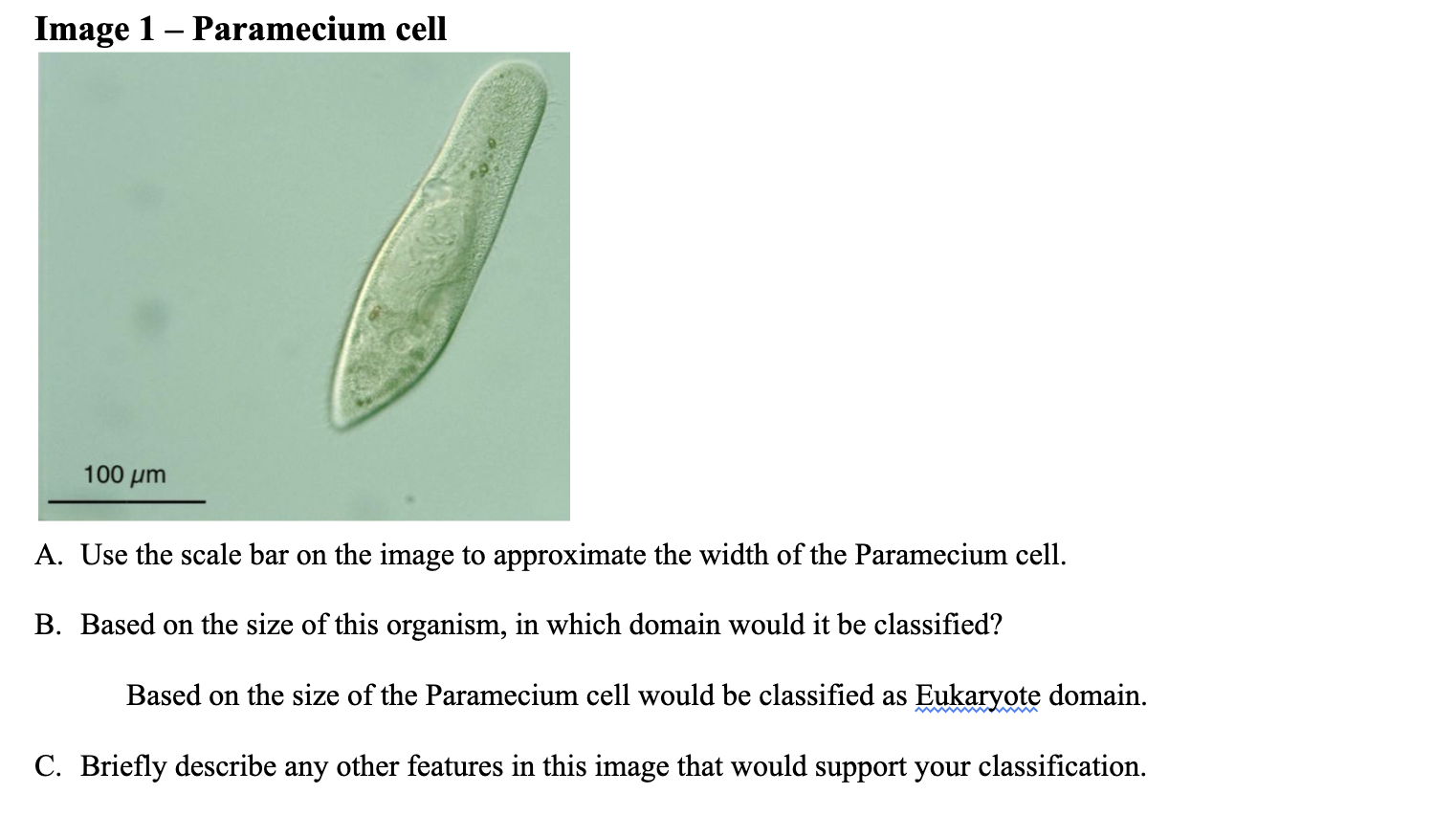 Image 1 - Paramecium cell
A. Use the scale bar on the image to approximate the width of the Paramecium cell.
B. Based on the 