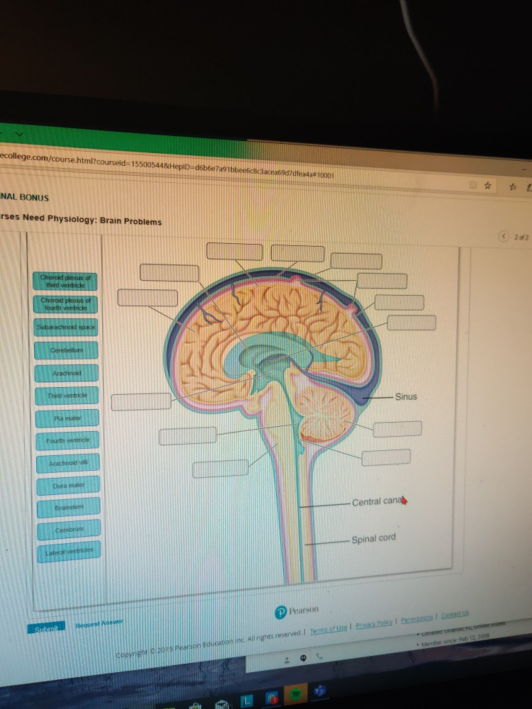Solved Nurses Need Physiology Brain Problems Man Anatomy Chegg Solved Nurses Need Physiology Brain Problems Man Anatomy Chegg