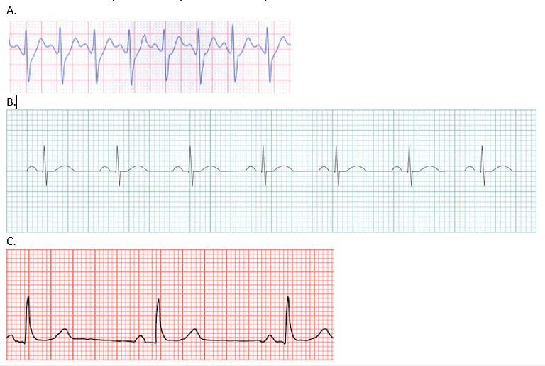 Solved 1. a. Calculate the heart rate in each of the three | Chegg.com