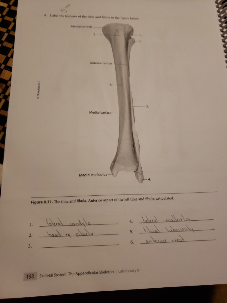 Solved 4. Label the features of the tibia and fibula in the | Chegg.com