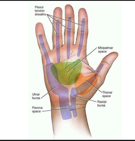 Hand Infections Flashcards Chegg Com