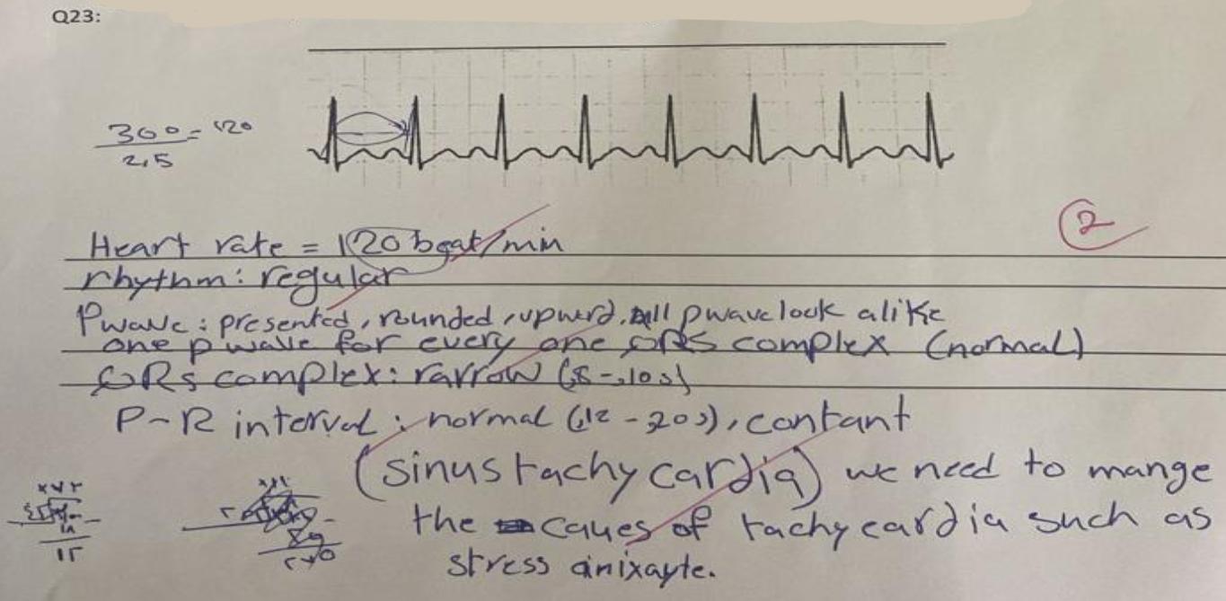 Solved 2,5300=120 Heart rate =120 beat /min rhythm: regular | Chegg.com