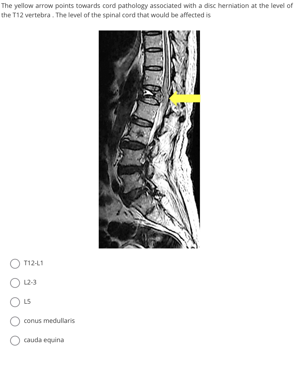 Pathology of the spine