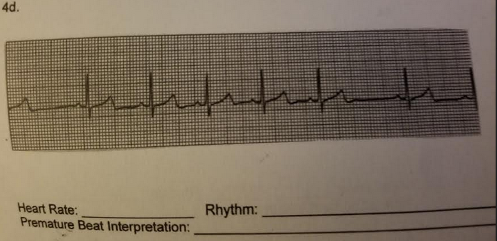 Solved Given this ECG, what is the HR, rhythm and premature | Chegg.com