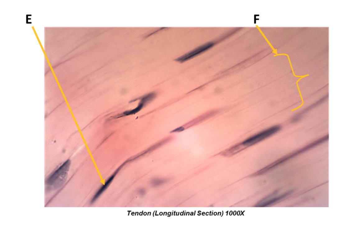 Solved What difference do you see between the tendon – | Chegg.com