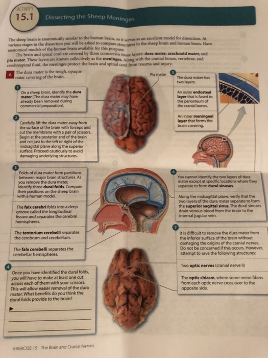 Solved 15.1 Dissecting the Sheep Meninges The sheep brain is | Chegg.com