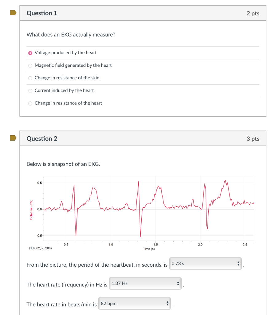 solved-question-1-2-pts-what-does-an-ekg-actually-measure-chegg