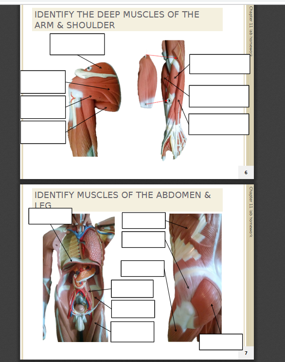 Solved IDENTIFY THE DEEP MUSCLES OF THE ARM & SHOULDER | Chegg.com