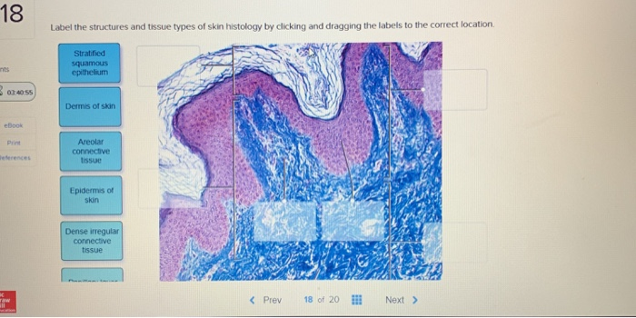 18 Label the structures and tissue types of skin | Chegg.com