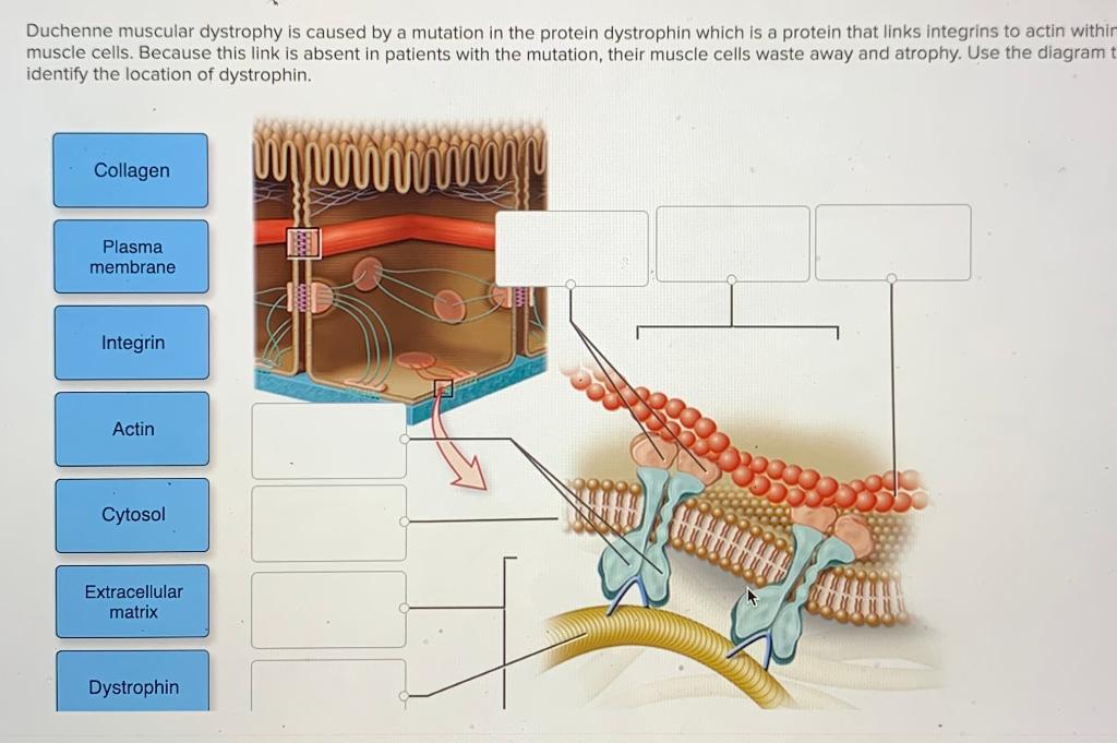 diagrams of people with muscular dystrophy