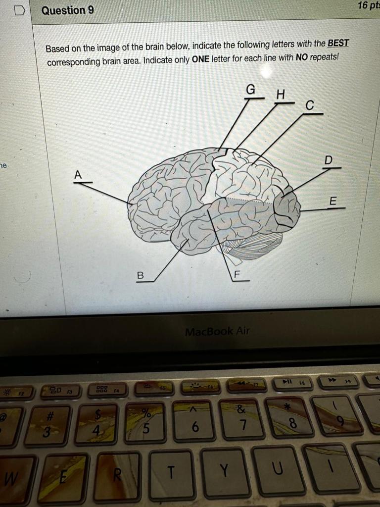 Solved Based on the image of the brain below, indicate the | Chegg.com