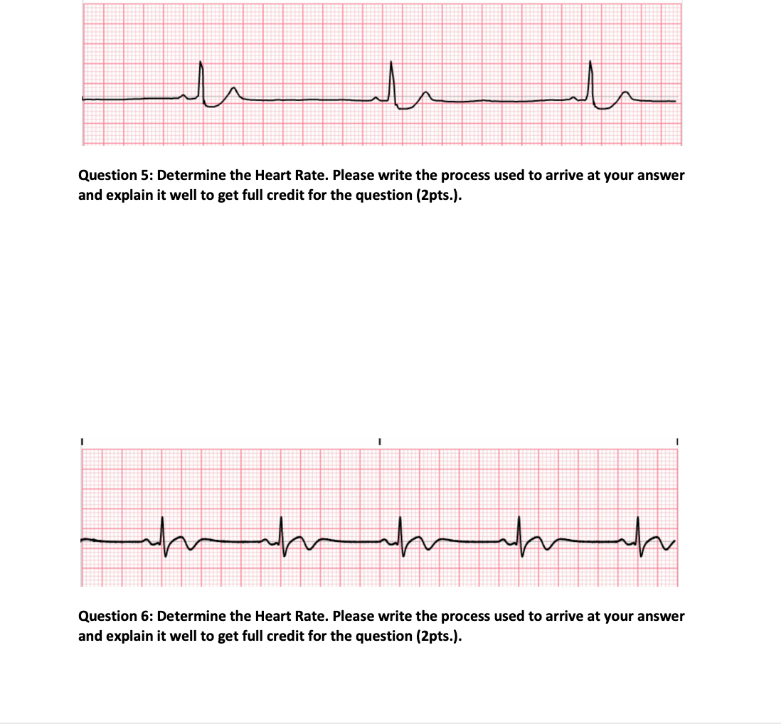 Solved Question 5: Determine The Heart Rate. Please Write | Chegg.com