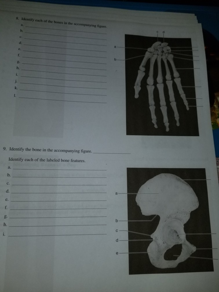 Solved 8. Identify Each Of The Bones In The Accompanying | Chegg.com