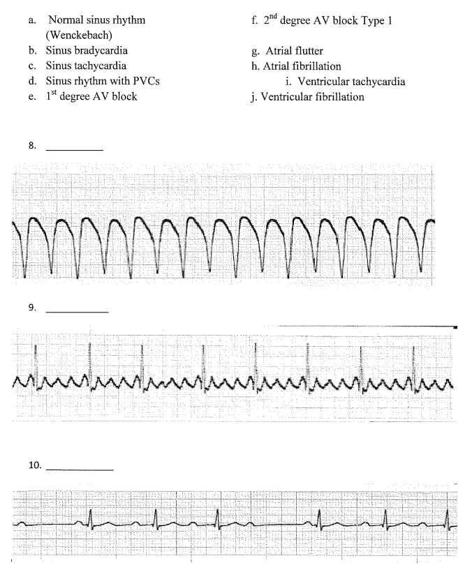 Solved Identify the following rhythm strips by matching the | Chegg.com